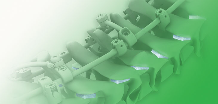 Medtronic Spine’s Newest Cervical Procedure Orthopedics