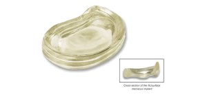 Polymer Meniscus Earns IDE From FDA | Orthopedics This Week