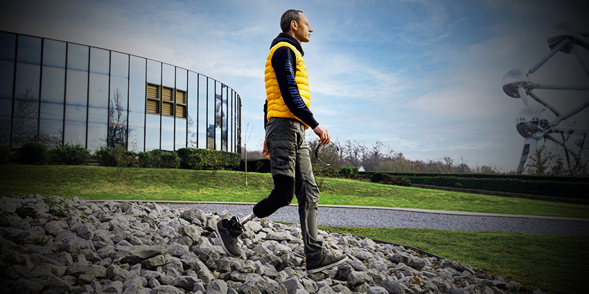 JBJS Case: Simple Trick to Dodge the Above-Knee Penalty