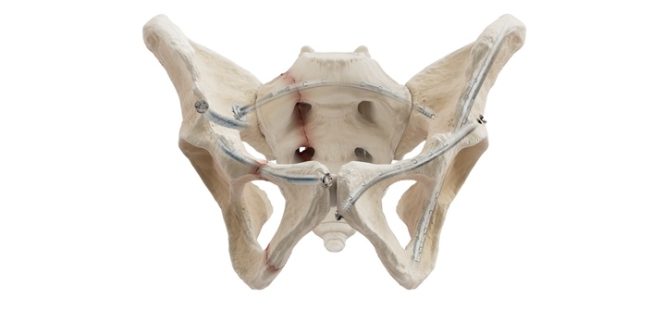 CurvaFix Expands National Market Access – Awarded Technology Breakthrough Designation With Premier Inc. for General Orthopedic Trauma Products