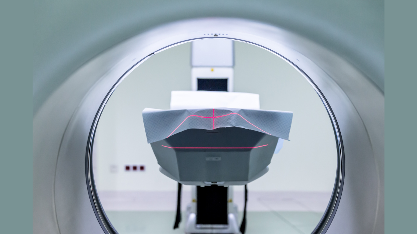 Fat Map Strikes Back: Best Infection Predictor in Lumbar Fusion