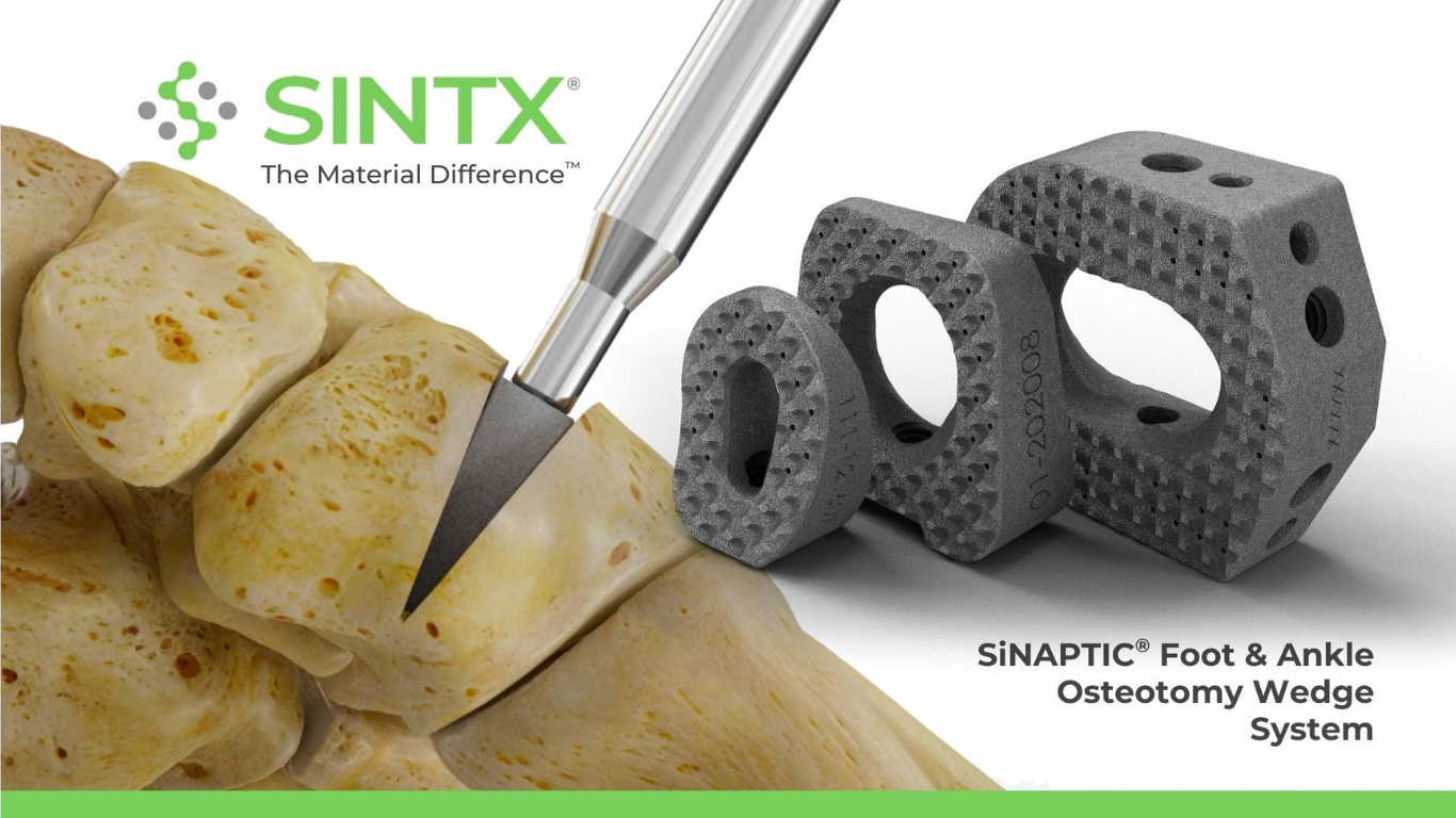SINTX Technologies Announces First-In-Human Surgery Using FDA-Cleared SINAPTIC® Foot & Ankle Implant