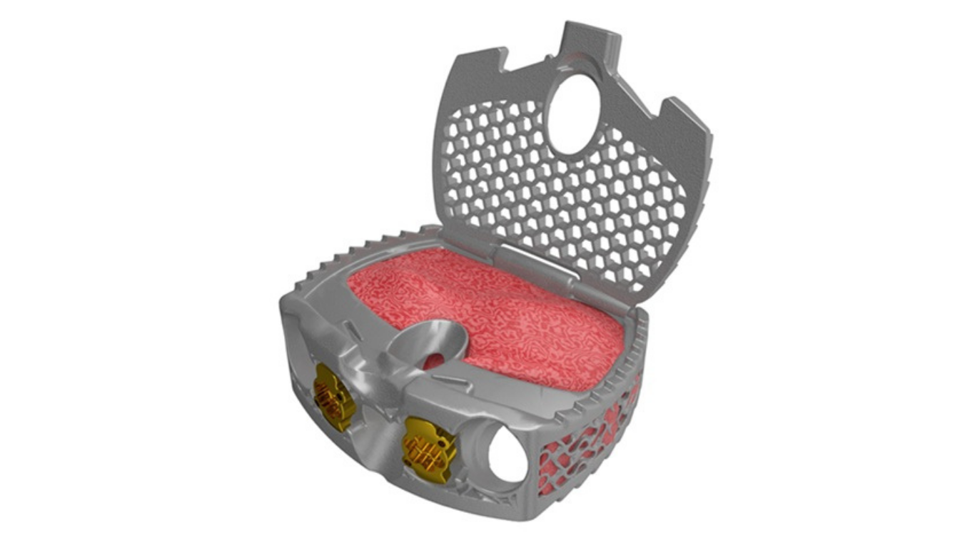 Spinal Elements Expands Ventana® Platform with FDA 510(k) Clearance and First Cases of Ventana® A ALIF System