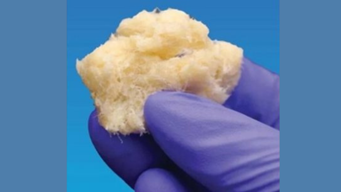 New Bone Fixer Helps Doctors Heal Bones